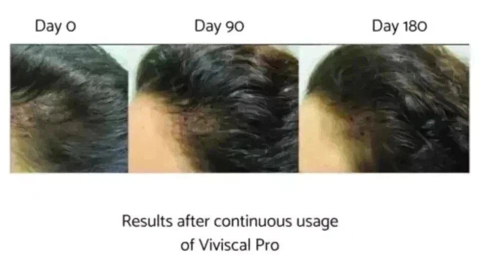 Viviscal Professional Hair Growth Formula 180 Tablets Men & Women